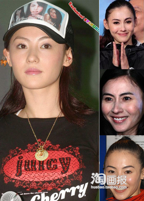 Gương mặt loang lổ, trắng đen không rõ của Trương Bá Chi dù có trang điểm cũng không che được.