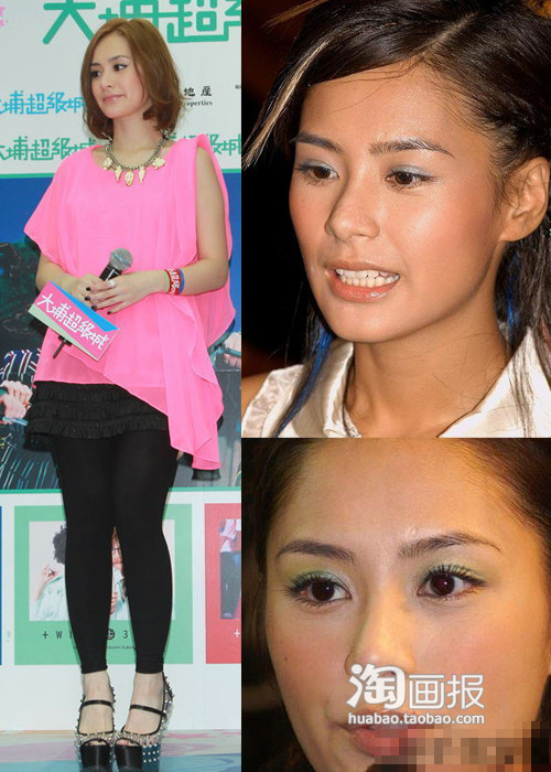 Dù còn trẻ nhưng nếp nhăn ở bọng mắt của Chung Hân Đồng vẫn khá nhiều.