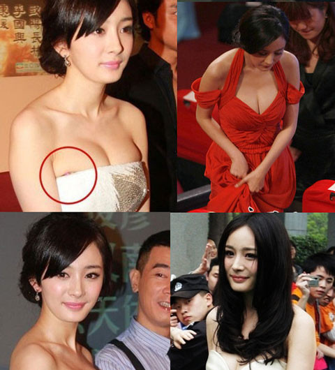 Cô cũng đã phải tiếp nhận những ý kiến trái chiều khác nhau về sự thay đổi rõ rệt của vòng một. Cô cũng đã phải tiếp nhận những ý kiến trái chiều khác nhau về sự thay đổi rõ rệt của vòng một.