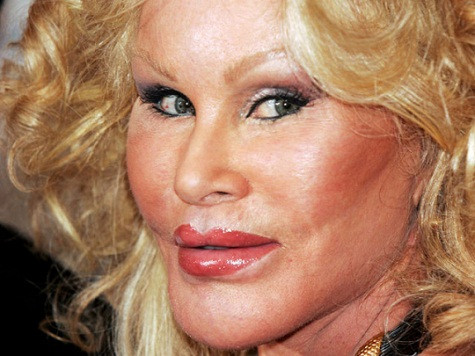 Jocelyn Wildenstein có gương mặt vô cùng đáng sợ. Xem thêm: Choáng váng - hàng loạt hoa hậu hóa "em chã". Jocelyn Wildenstein có gương mặt vô cùng đáng sợ. Xem thêm: Choáng váng - hàng loạt hoa hậu hóa "em chã".