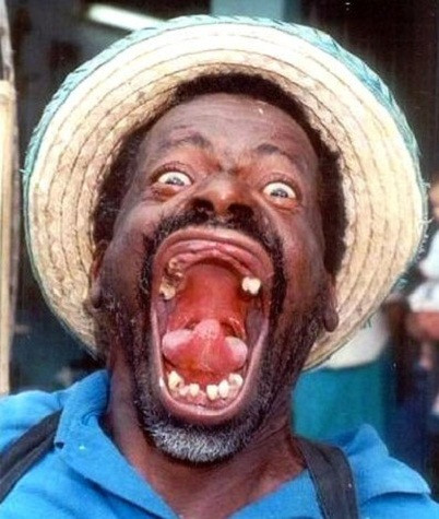 Và đây, chân dung Người đàn ông xấu xí nhất thế giới! Xem thêm: Choáng váng - hàng loạt hoa hậu hóa "em chã". Và đây, chân dung Người đàn ông xấu xí nhất thế giới! Xem thêm: Choáng váng - hàng loạt hoa hậu hóa "em chã".