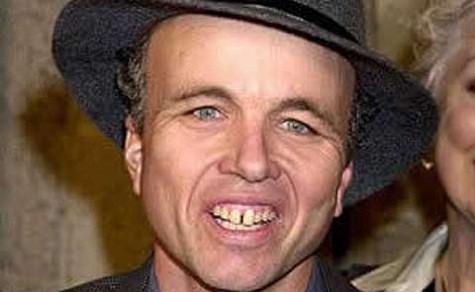 Clint Howard không nghĩ đến việc cải thiện hàm răng, vì anh biết rằng, có cải thiện thì độ đẹp trai cũng chẳng hơn được bao nhiêu. Xem thêm: Choáng váng - hàng loạt hoa hậu hóa "em chã". Clint Howard không nghĩ đến việc cải thiện hàm răng, vì anh biết rằng, có cải thiện thì độ đẹp trai cũng chẳng hơn được bao nhiêu. Xem thêm: Choáng váng - hàng loạt hoa hậu hóa "em chã".