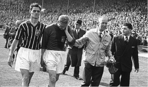 Bert Trautmann (thứ hai từ trái sang) rời sân Wembley với cái cổ gãy. Ảnh chụp X-quang sau đó tiết lộ ông bị trật đốt sống cổ và suýt mất mạng Bert Trautmann (thứ hai từ trái sang) rời sân Wembley với cái cổ gãy. Ảnh chụp X-quang sau đó tiết lộ ông bị trật đốt sống cổ và suýt mất mạng