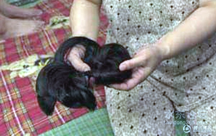 Mẹ Liu Fei xót xa cho phóng viên xem mớ tóc rụng của con gái. Mẹ Liu Fei xót xa cho phóng viên xem mớ tóc rụng của con gái.