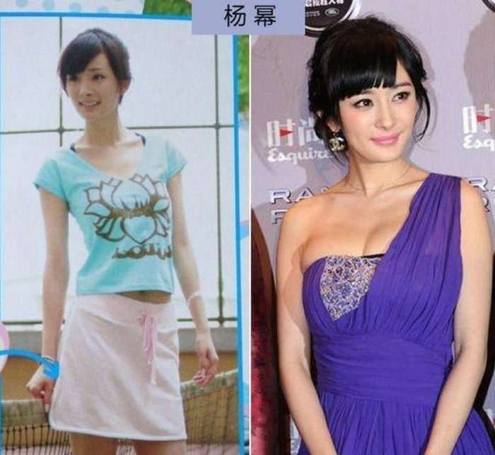 Tiểu hoa đán Dương Mịch cũng đã gây ra không ít xôn xao với vòng một bất thường mà ai cũng cho đó là sản phẩm sau phẫu thuật. Tiểu hoa đán Dương Mịch cũng đã gây ra không ít xôn xao với vòng một bất thường mà ai cũng cho đó là sản phẩm sau phẫu thuật.