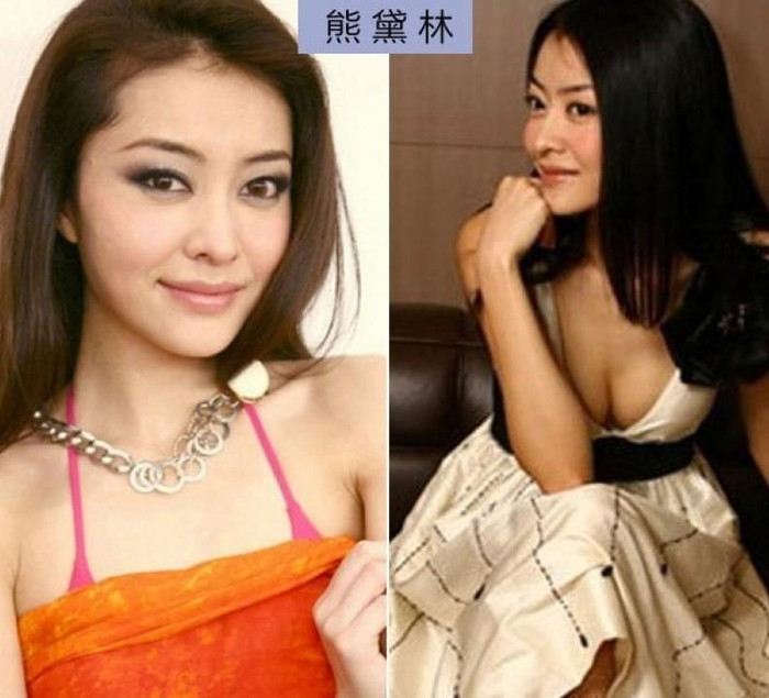 Siêu mẫu Hùng Đại Lâm không chỉ phẫu thuật mặt mà vòng một cũng là sản phẩm của dao kéo. Siêu mẫu Hùng Đại Lâm không chỉ phẫu thuật mặt mà vòng một cũng là sản phẩm của dao kéo.