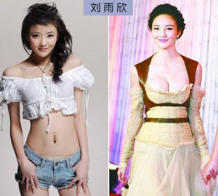 Lưu Vũ Hân từng khiến đông đảo mọi người biết đến vì sự cố "chèn ép vòng một" đến mức có thể thấy được cả đường gân xanh trên đó. Nhưng so với trước, liệu đôi gò bồng đó có thực là "sản phẩm" tự nhiên không? Lưu Vũ Hân từng khiến đông đảo mọi người biết đến vì sự cố "chèn ép vòng một" đến mức có thể thấy được cả đường gân xanh trên đó. Nhưng so với trước, liệu đôi gò bồng đó có thực là "sản phẩm" tự nhiên không?