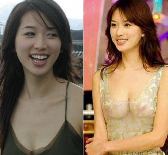 Dù sở hữu dáng người mơ ước, eo thon, chân dài, khuôn mặt đẹp nhưng có lẽ Lâm Chí Linh cũng đã phải "nâng cấp" vòng một để trở nên hoàn hảo hơn. Dù sở hữu dáng người mơ ước, eo thon, chân dài, khuôn mặt đẹp nhưng có lẽ Lâm Chí Linh cũng đã phải "nâng cấp" vòng một để trở nên hoàn hảo hơn.