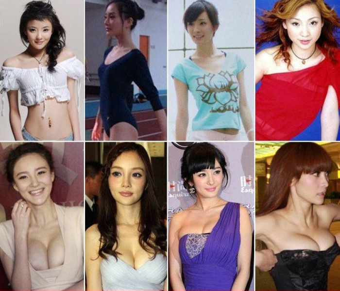 Sự thay đổi rõ rệt trong số đo vòng một của những người đẹp màn ảnh Hoa ngữ có thể chứng minh cho một điều, đó là sản phẩm của dao kéo? Sự thay đổi rõ rệt trong số đo vòng một của những người đẹp màn ảnh Hoa ngữ có thể chứng minh cho một điều, đó là sản phẩm của dao kéo?