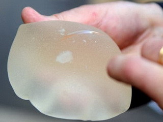 Túi nâng ngực PIP - Ảnh: AFP Túi nâng ngực PIP - Ảnh: AFP