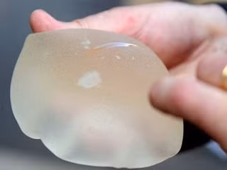 Túi nâng ngực PIP - Ảnh: AFP Túi nâng ngực PIP - Ảnh: AFP