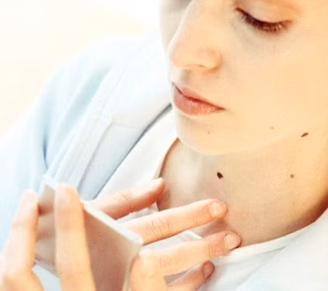 2. Nhiều nốt ruồi: Tuổi già sẽ đến muộn. Trên cơ thể mà có nhiều nốt ruồi sẽ không chỉ khó coi mà còn tăng nguy cơ ung thư da. Nhưng các nhà khoa học Đại học Hoàng gia London cho biết, người nhiều nốt ruồi thường có vẻ ngoài trẻ hơn 6 - 7 tuổi, xác suất bị bệnh tim và bệnh loãng xương của tuổi già tương đối thấp.