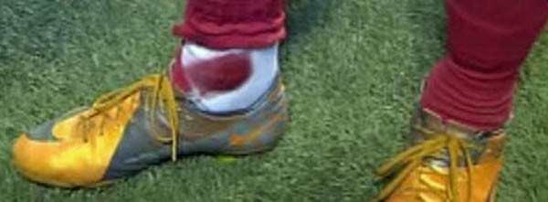 Tới mức đôi chân của anh bị rỉ máu Tới mức đôi chân của anh bị rỉ máu