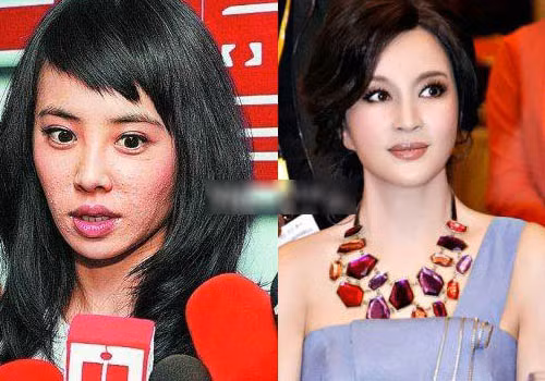 Dù đã 60 nhưng Lưu Hiểu Khánh vẫn giữ được một làn da rất mịn màng trái ngược hoàn toàn với Thái Y Lâm. Dù đã 60 nhưng Lưu Hiểu Khánh vẫn giữ được một làn da rất mịn màng trái ngược hoàn toàn với Thái Y Lâm.