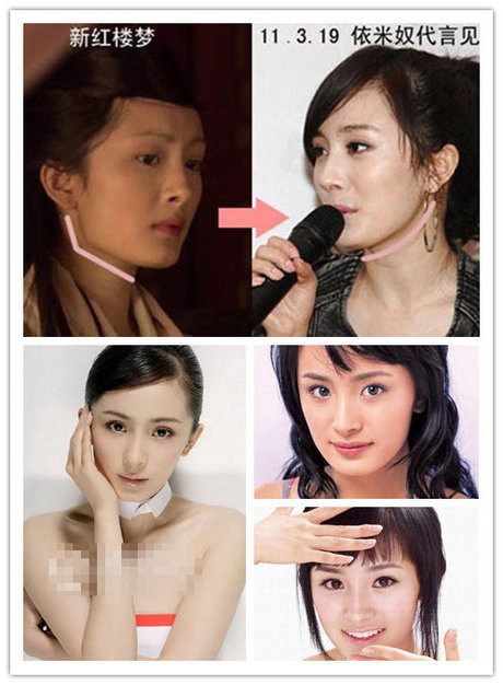 Đã có rất nhiều tin đồn về vấn đề phẫu thuật thẩm mỹ của người đẹp Dương Mịch, nhưng cho đến nay cô vẫn luôn im lặng. Cư dân mạng đã so sánh những tấm ảnh trong quá khứ và hiện tại để chứng minh Dương Mịch từng "cậy nhờ" dao kéo.