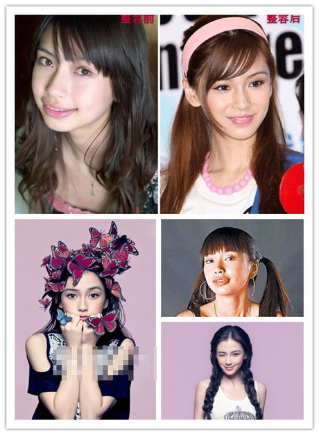 Angela Baby đã từng phẫu thuật là điều ai cũng biết.