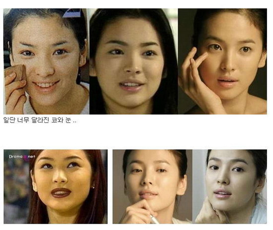 Được mệnh danh là "đệ nhất mỹ nữ" Hàn Quốc, nhưng trước đó Song Hye Kyo cũng đã từng một thời má ú môi thâm khiến mọi người đều không nhận ra.