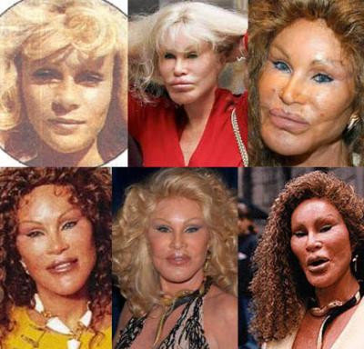 Jocelyn Wildenstein Jocelyn Wildenstein