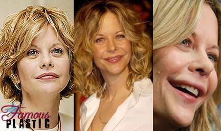 Meg Ryan Meg Ryan