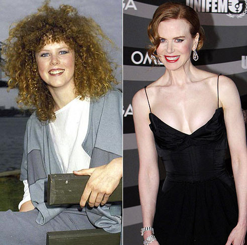 Xuất hiện trên màn ảnh nhỏ từ năm 1983, khi ấy Nicole Kidman chỉ 15 tuổi. Với nụ cười trẻ trung làm mê hoặc lòng người, gương mặt Nicole vẫn căng mịn, dù đã 45 tuổi. Xem thêm: Sao Hoa ngữ/Sao Việt/Sao Hàn/Sao Hollywood Xuất hiện trên màn ảnh nhỏ từ năm 1983, khi ấy Nicole Kidman chỉ 15 tuổi. Với nụ cười trẻ trung làm mê hoặc lòng người, gương mặt Nicole vẫn căng mịn, dù đã 45 tuổi. Xem thêm: Sao Hoa ngữ/Sao Việt/Sao Hàn/Sao Hollywood