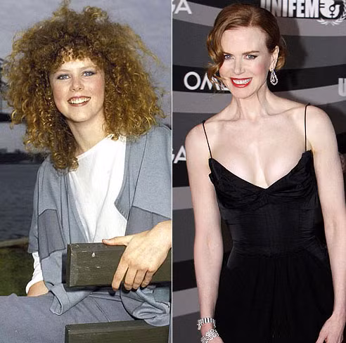 Xuất hiện trên màn ảnh nhỏ từ năm 1983, khi ấy Nicole Kidman chỉ 15 tuổi. Với nụ cười trẻ trung làm mê hoặc lòng người, gương mặt Nicole vẫn căng mịn, dù đã 45 tuổi. Xem thêm: Sao Hoa ngữ/Sao Việt/Sao Hàn/Sao Hollywood Xuất hiện trên màn ảnh nhỏ từ năm 1983, khi ấy Nicole Kidman chỉ 15 tuổi. Với nụ cười trẻ trung làm mê hoặc lòng người, gương mặt Nicole vẫn căng mịn, dù đã 45 tuổi. Xem thêm: Sao Hoa ngữ/Sao Việt/Sao Hàn/Sao Hollywood