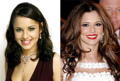 Dù sở hữu đôi má lúm đồng tiền xinh nhưng nếu không chỉnh sửa lại hàm răng thì Cheryl không thể xinh đẹp như ngày hôm nay Xem thêm: Ngắm Sao Việt thuở còn..."răng sữa"/Scarlett Johansson "mất điểm" vì hàm răng ố vàng và mập ú/Thảm họa thẩm mỹ của Sao Dù sở hữu đôi má lúm đồng tiền xinh nhưng nếu không chỉnh sửa lại hàm răng thì Cheryl không thể xinh đẹp như ngày hôm nay Xem thêm: Ngắm Sao Việt thuở còn..."răng sữa"/Scarlett Johansson "mất điểm" vì hàm răng ố vàng và mập ú/Thảm họa thẩm mỹ của Sao