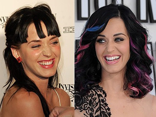 Katy Perry có hàm răng trắng sáng hơn xưa rất nhiều. Xem thêm: Ngắm Sao Việt thuở còn..."răng sữa"/Scarlett Johansson "mất điểm" vì hàm răng ố vàng và mập ú/Thảm họa thẩm mỹ của Sao Katy Perry có hàm răng trắng sáng hơn xưa rất nhiều. Xem thêm: Ngắm Sao Việt thuở còn..."răng sữa"/Scarlett Johansson "mất điểm" vì hàm răng ố vàng và mập ú/Thảm họa thẩm mỹ của Sao