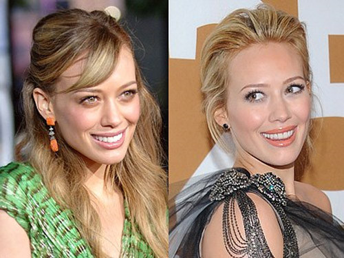 Hilary Duff đã thẩm mỹ bộ răng của mình và dĩ nhiên nó đều đặn và đẹp hơn hẳn. Xem thêm: Ngắm Sao Việt thuở còn..."răng sữa"/Scarlett Johansson "mất điểm" vì hàm răng ố vàng và mập ú/Thảm họa thẩm mỹ của Sao Hilary Duff đã thẩm mỹ bộ răng của mình và dĩ nhiên nó đều đặn và đẹp hơn hẳn. Xem thêm: Ngắm Sao Việt thuở còn..."răng sữa"/Scarlett Johansson "mất điểm" vì hàm răng ố vàng và mập ú/Thảm họa thẩm mỹ của Sao