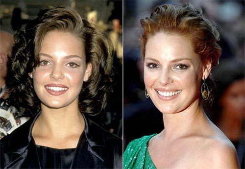 Katherine Heigl từng thừa nhận là cô phải niềng răng trong vài tháng để có một hàm răng đều đẹp trong ngày cưới của mình Xem thêm: Ngắm Sao Việt thuở còn..."răng sữa"/Scarlett Johansson "mất điểm" vì hàm răng ố vàng và mập ú/Thảm họa thẩm mỹ của Sao Katherine Heigl từng thừa nhận là cô phải niềng răng trong vài tháng để có một hàm răng đều đẹp trong ngày cưới của mình Xem thêm: Ngắm Sao Việt thuở còn..."răng sữa"/Scarlett Johansson "mất điểm" vì hàm răng ố vàng và mập ú/Thảm họa thẩm mỹ của Sao