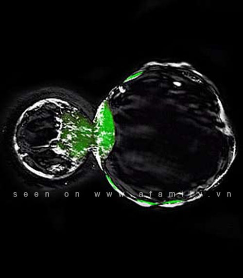 Top 5 nghiên cứu y học đột phá thế giới năm 2011 ảnh 1