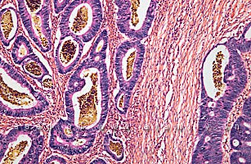 Top 5 nghiên cứu y học đột phá thế giới năm 2011 ảnh 4