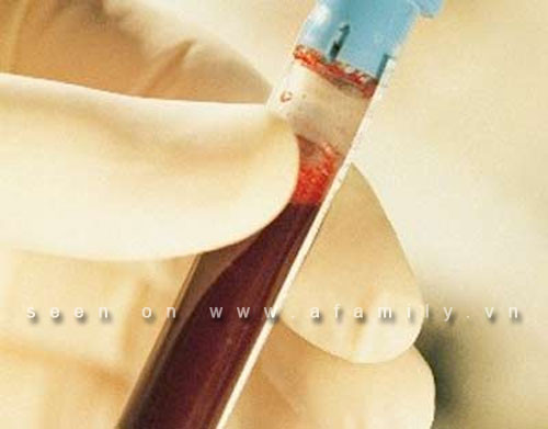 Top 5 nghiên cứu y học đột phá thế giới năm 2011 ảnh 5