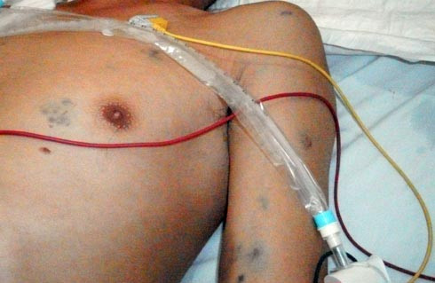 Nạn nhân Nguyễn Thanh Hiền khi được cấp cứu tại bệnh viện.