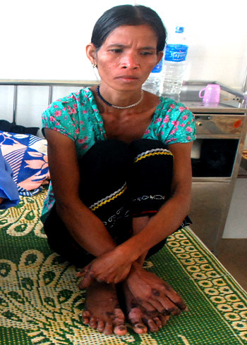 Bệnh lạ. Ảnh: H.N.