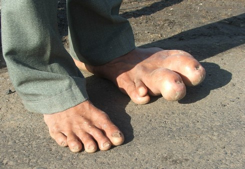 Bàn chân khổng lồ: Ảnh: Thiên Lý.