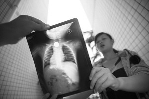 Hình ảnh chụp phim X-quang cho thấy, có vật thể lạ hình tròn trong người bé Ngưu Ngưu.