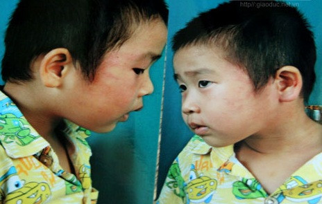 Bé 4 tuổi bị cô giáo tát: Phòng Giáo dục chỉ... tham mưu! ảnh 1 b
