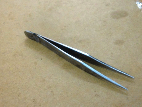Cứu sống bệnh nhân nuốt nhíp sắt dài 12 cm ảnh 1 Cứu sống bệnh nhân nuốt nhíp sắt dài 12 cm ảnh 1
