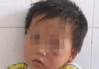 Bé 3 tuổi bị chó cắn “của quý” 