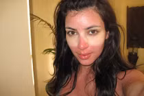 Mẹo "cứu cánh" làn da cháy nắng mùa Hè 