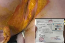 Vụ GV để trẻ bị bỏng khi pha sữa: Trường MN tư thục Vạn Phúc bị tạm đình chỉ