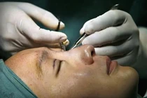 Con sốt thẩm mỹ 'càn quét' thiếu nữ đôi mươi