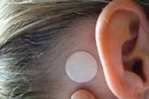 Dán chống say xe, bé 7 tuổi không nhận ra người thân