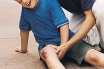 Con bị chấn thương nhỏ, mẹ hãy xử lý nhanh