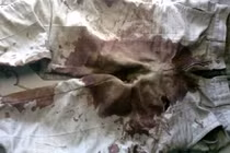 Nghệ An: Bị "phăng" đứt “của quý” vì gặp vợ hàng xóm