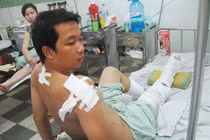 Nghi án đi hút đinh bị "đinh tặc" chém dã man