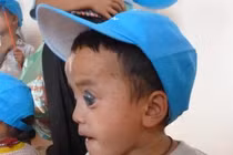 Ánh sáng cuối đường hầm đã đến với cậu bé mồ côi mang dị tật ở mắt