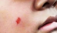 Ai sẽ bảo vệ giáo viên khi bị bạo hành?