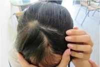 Cô giáo đánh học sinh vì không cho bạn chép bài