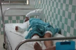 Đang ngồi trong phòng trọ, cặp tình nhân bị tạt axit nguy kịch